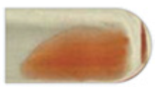 <p>Negative Reaction</p><p>Negative, no agglutination, smooth suspension of cells.</p>