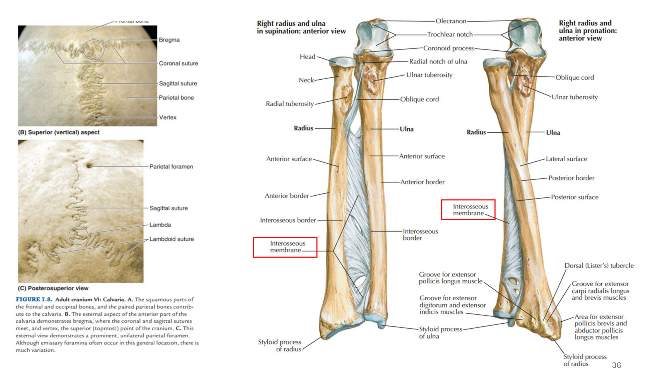 <p><strong>Union par du tissu fibreux (articulation fibreuse)</strong></p><ul><li><p>Favorise une stabilité entre les os</p></li><li><p>Permet peu ou pas de mouvement</p></li><li><p>Exemples</p><ul><li><p>Soutures (articulations immobiles entre les os du crâne)</p></li><li><p>Syndesmoses (deux os sont reliés par un ligament ou une membrane fibreuse): membranes interosseuses</p></li></ul></li></ul><p></p>