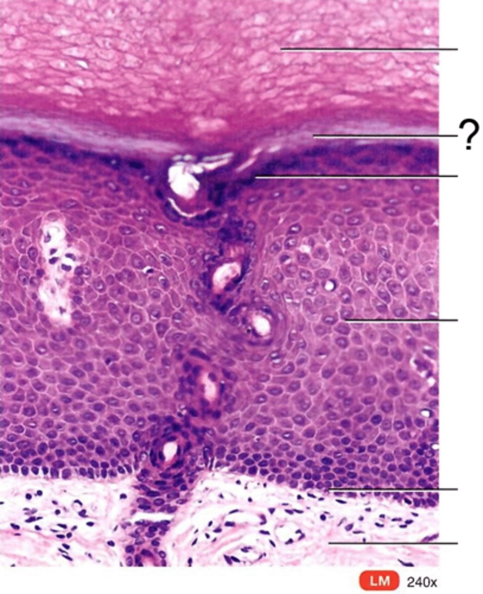 <p>Clear, transparent layer of the epidermis under the stratum corneum.</p>