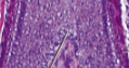 <p>Hair matrix</p>