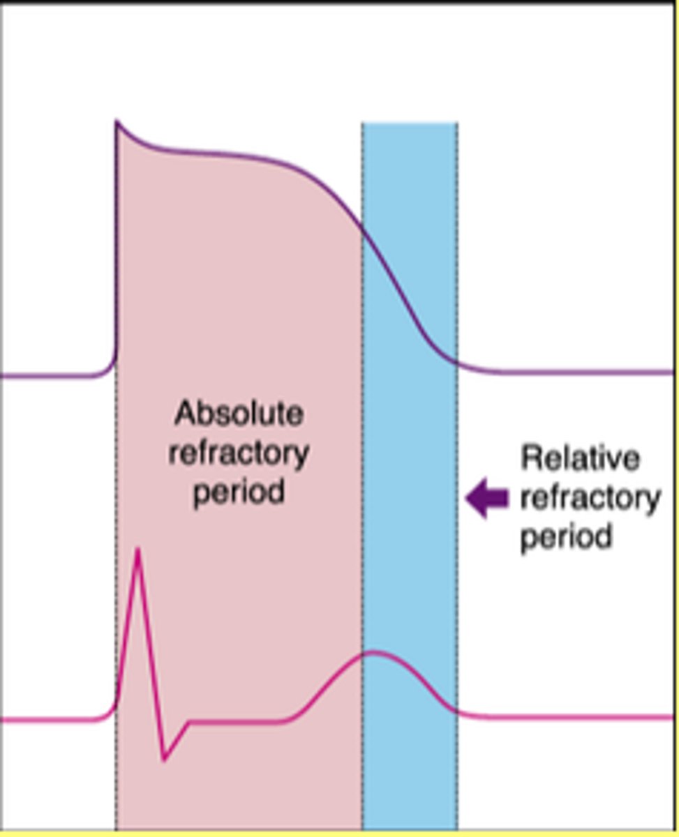 <p>a period of inactivity represented by horizontal line on ECG</p>