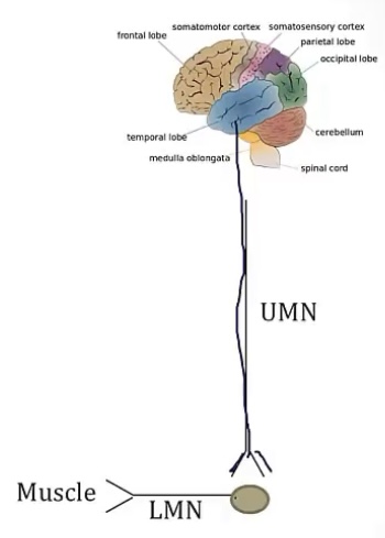 <p>-brain; second nerve; cortex, internal capsule, or corticospinal tract</p><p>-second nerve; muscle/target; brainstem, spinal cord/anterior horn</p><p>-spastic, hyperreflexia, and overactive muscle; flaccid, muscle twitches/fasciculations, and loss of reflexes</p>