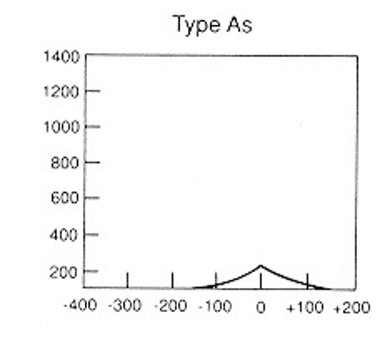 <p>Tymps similar to a typical ear, but the peak is extremely low. The middle ear system becomes less compliant, more stiff.</p>