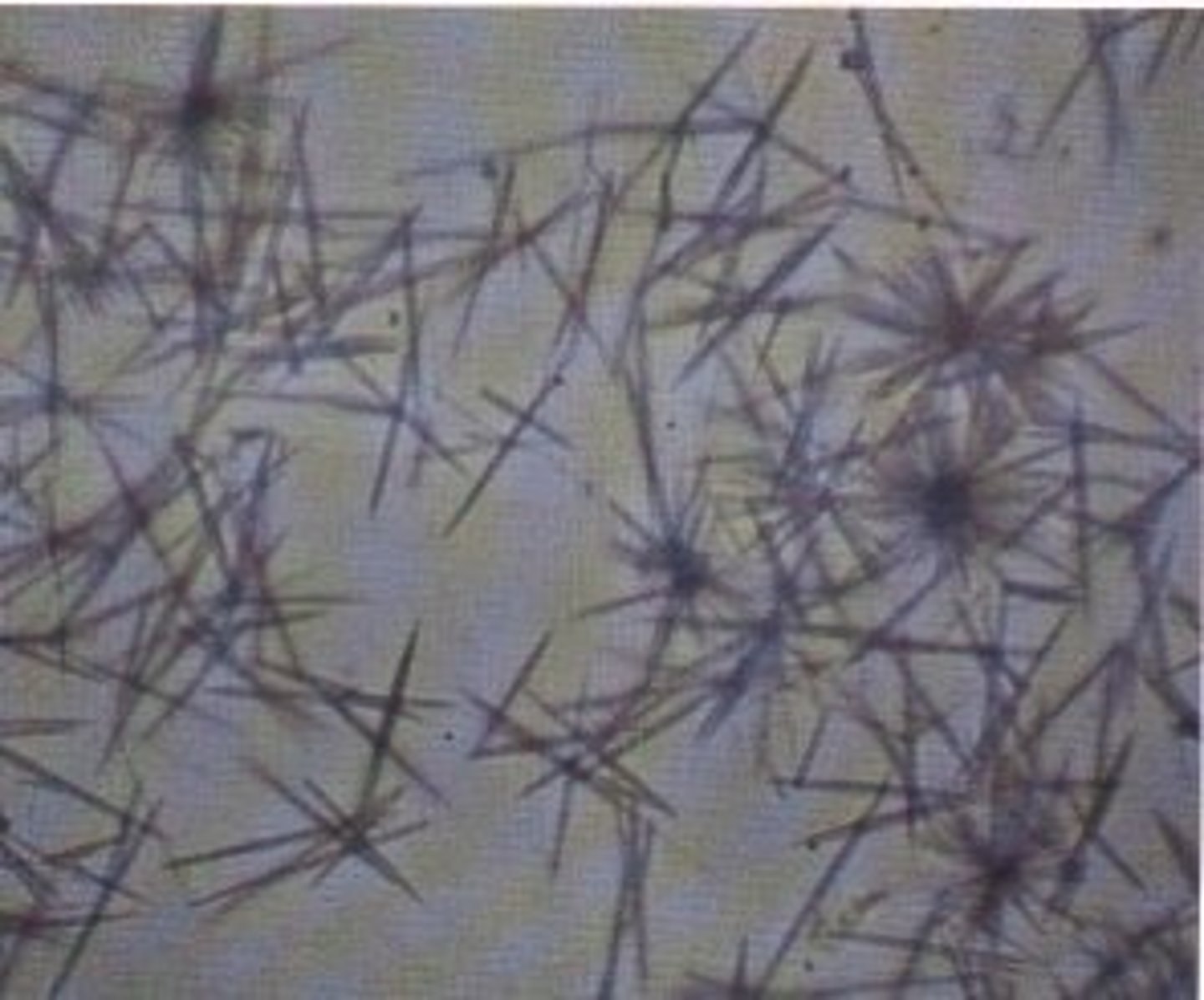 <p>What is being shown histologically?</p>