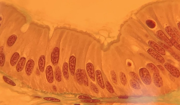 <p>What kind of epithelial tissue is this?</p>