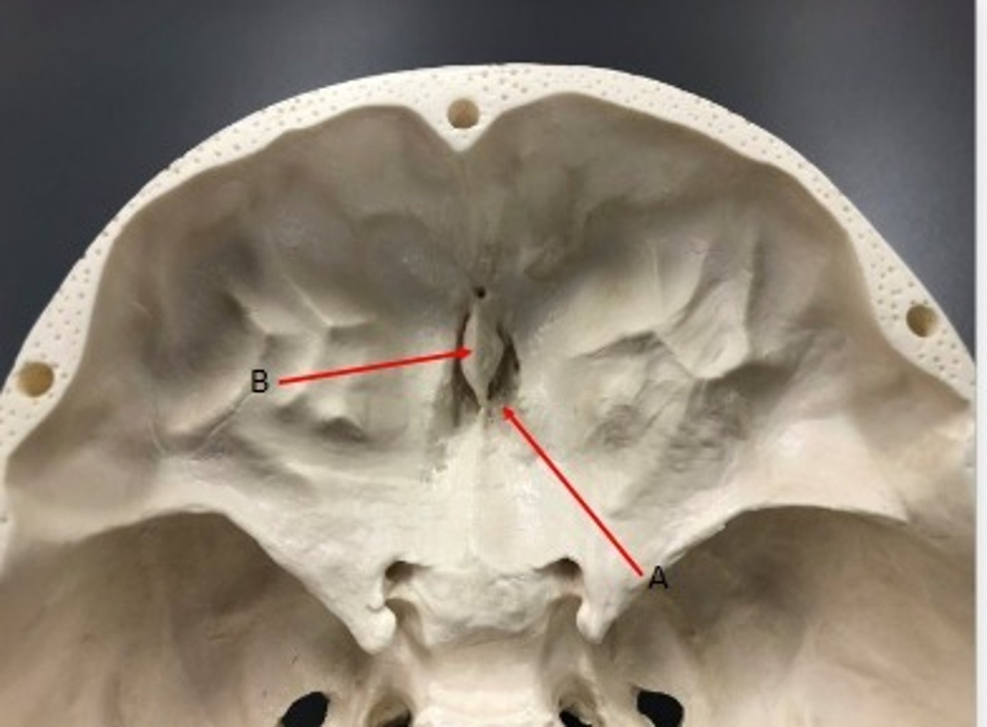 <p>What category of bone is it? What bone is it? Label the structures.</p>
