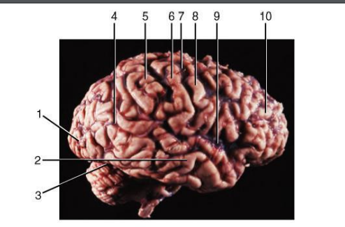 <p>(6) Postcentral gyrus function</p>