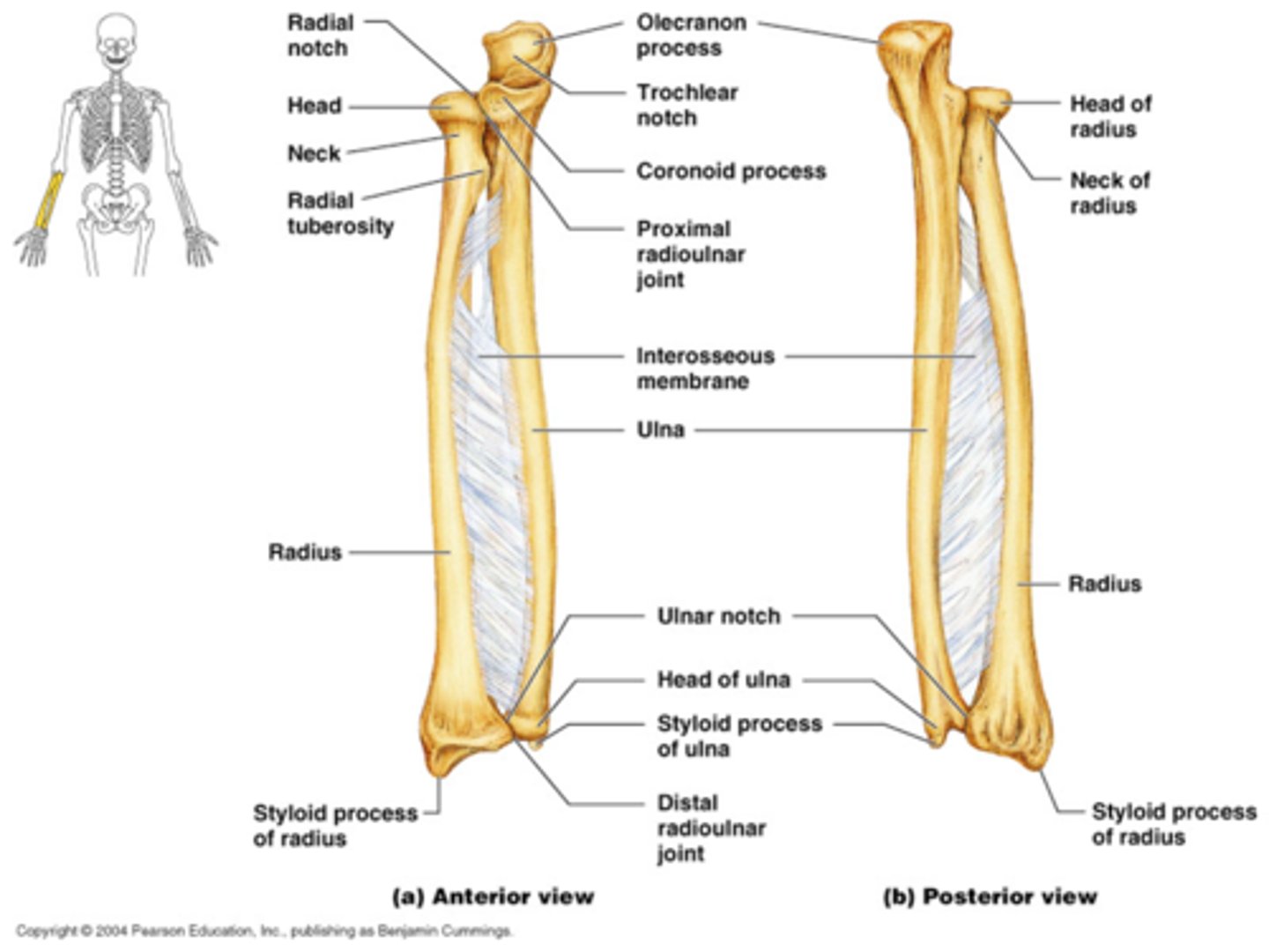 <p>distal end of ulna</p>