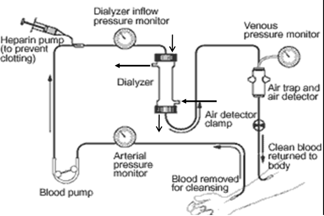 <p><span>Typical schedule 3x/week (MWF/TTS)</span></p><p><span>4hr/treatment, depends on fluid status</span></p>