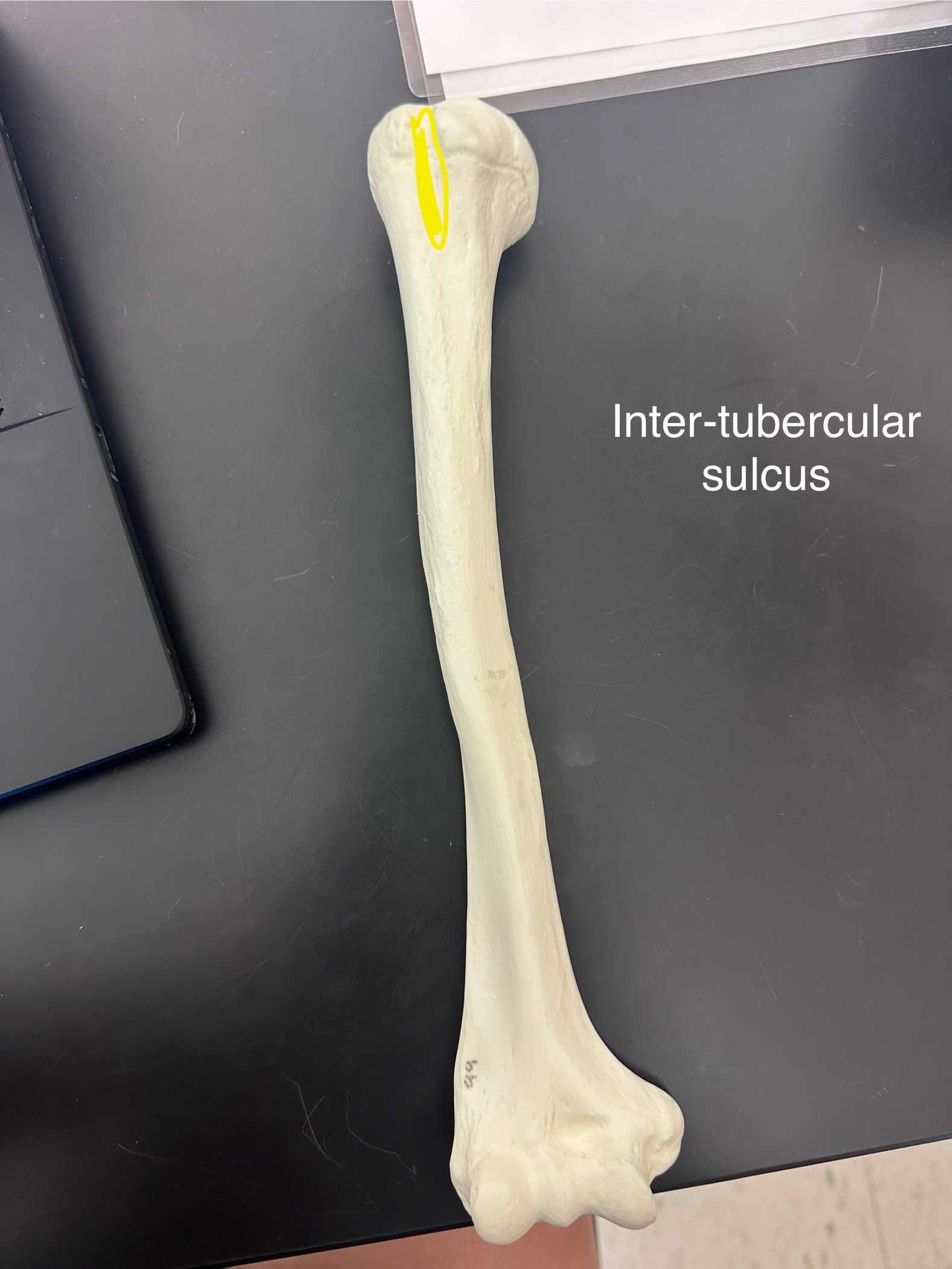 <p>Inter-tubercular sulcus</p>