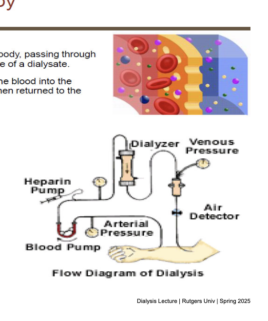 <ul><li><p>definition</p><ul><li><p>process of removing heparinized blood (anticoagulant) from the body, passing thru a semi-permeable membrane on the opposite side of a dialysate</p></li><li><p>waste products and extra body fluid move from the blood → dialysate and is discarded; clean blood is then returned to the patients</p></li><li><p>for patients who are hemodynamically stable</p></li></ul></li><li><p>vascular access</p><ul><li><p>IV catheter, arteriovenous fistula</p></li></ul></li><li><p>dialyzers</p><ul><li><p>high flux (most common)</p><ul><li><p>blood flow = ~500 mL/min</p></li><li><p>3-4 hour sessions</p></li><li><p>3 times a week</p></li></ul></li></ul></li><li><p>dialyzers (high flux)</p><ul><li><p>artificial fibers that mimic kidney’s filtering function</p><ul><li><p>polysulfone</p></li><li><p>polymethylmethacrylate</p></li><li><p>polyacrylonitrile</p></li></ul></li></ul></li><li><p>dialysate</p><ul><li><p>fluid that is on the opposite side of the membrane from the blood</p></li><li><p>concurrent flow → dialysate moves in the opposite direction to blood → maximizes gradient and waste removal</p></li><li><p>flow rate = 500-800 mL/min</p></li><li><p>various solutes and anticoagulants</p></li></ul></li><li><p>waste and fluid removal</p><ul><li><p>diffusion → solutes like urea, creatinine, K+</p></li><li><p>ultrafiltration → removal of <strong>excess water</strong> via <strong>pressure gradient</strong></p></li><li><p>concentration gradient against the dialyzer membrane (pull water out)</p></li></ul></li><li><p>dialysis prescription</p><ul><li><p>flow rate</p></li><li><p>duration of dialysis</p></li><li><p>dialyzer</p></li></ul></li><li><p>measures of adequacy</p><ul><li><p>urea reduction ratio (URR)</p><ul><li><p>[(BUN<sub>pre</sub> - BUN<sub>post</sub>)/BUN<sub>pre</sub>]*100</p></li><li><p><strong>&gt;70%</strong> is considered adequate (KDOQI guidelines)</p></li></ul></li><li><p>Kt/V</p><ul><li><p>Kt = dialyzer CL of urea</p></li><li><p>T = duration of dialysis</p></li><li><p>V = volume of blood cleared from urea</p></li><li><p>Goal = Kt/V &gt;=<strong> 1.3</strong></p></li></ul></li></ul></li><li><p>properties of a dialyzable drug</p><ul><li><p>MW <strong>&lt;5000 Da</strong></p></li><li><p>Vd <strong>&lt;1 L/kg</strong> (mostly stays in plasma)<br>protein binding <strong>&lt;90%</strong> (only free drug is dialyzable)</p></li><li><p>low lipid solubility (hydrophilic drugs stay in plasma)</p></li></ul></li></ul><p></p>