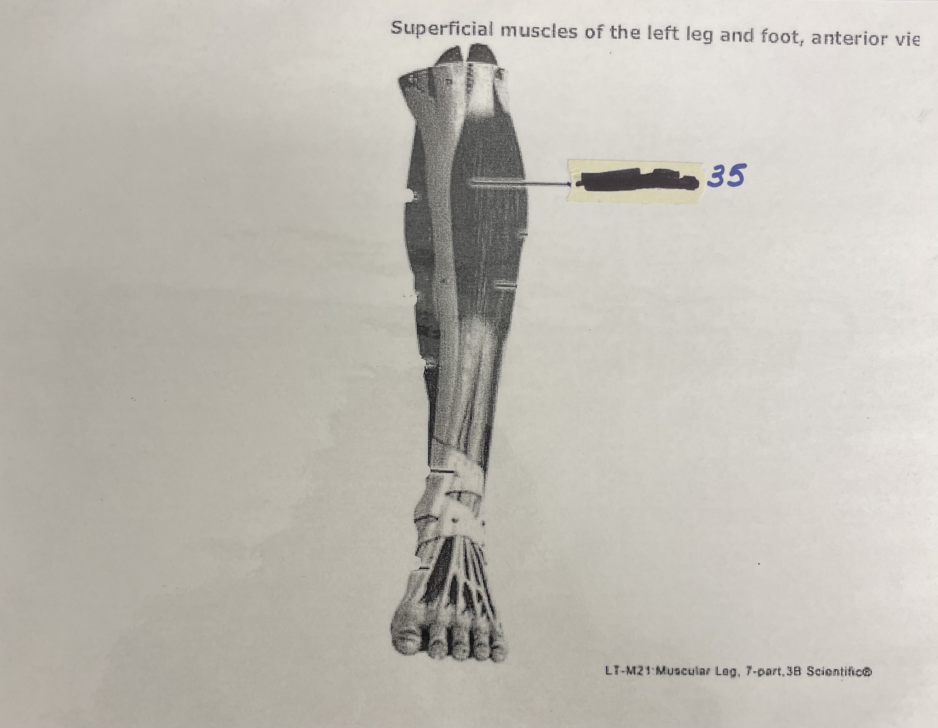 Name the muscle