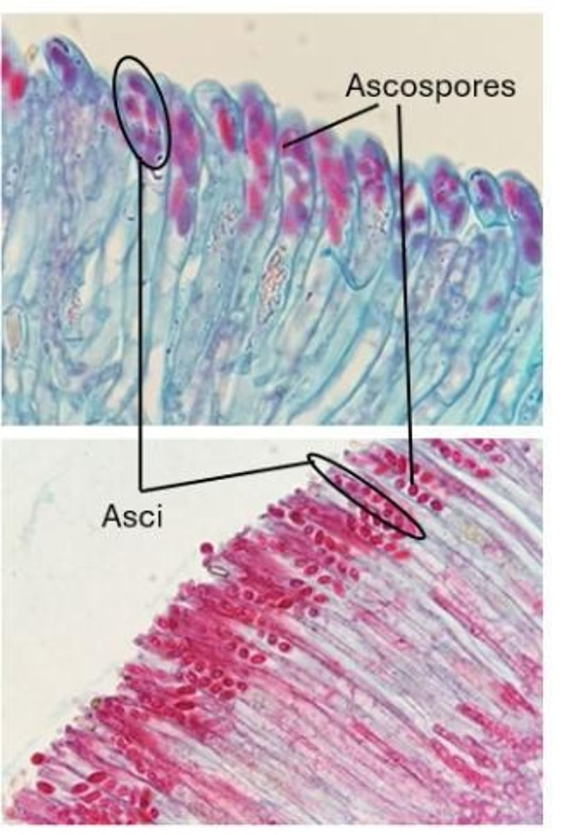 <p>Because they reproduce sexually using a saclike structure called an ascus.</p>