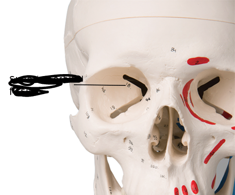 <p>bony marking?</p>