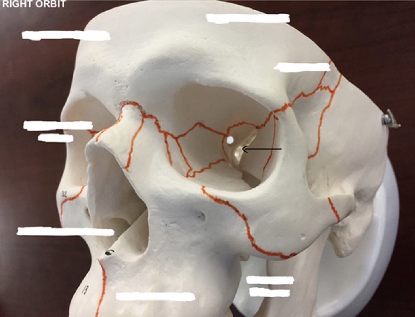 <p>What structure is pointed to here?</p>
