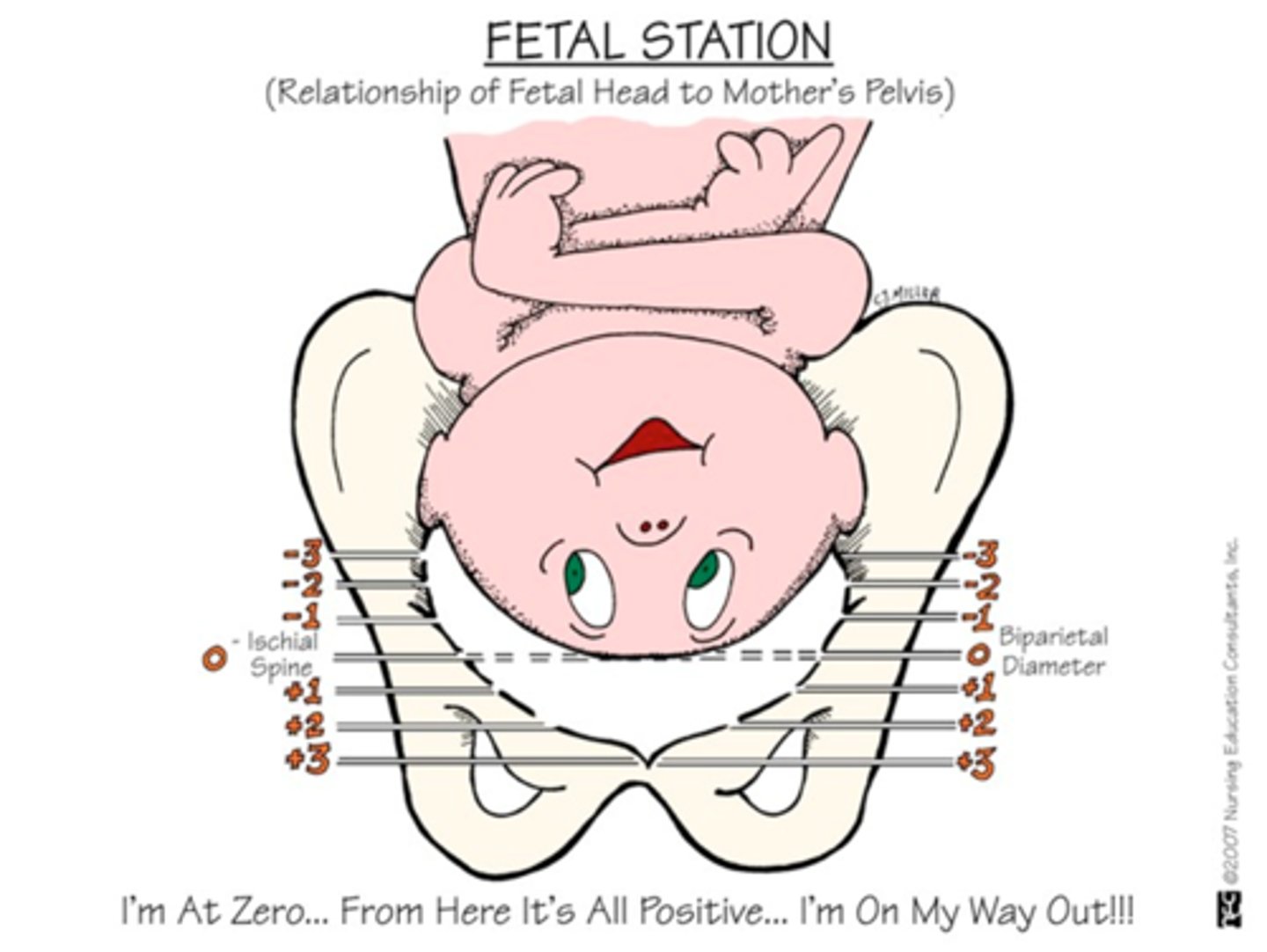 <p>a measure of the degree of descent of the presenting part of the fetus through the birth canal</p>