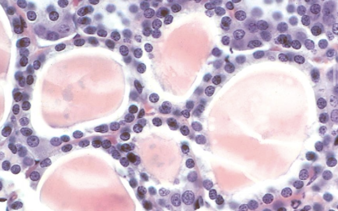 <p>What type of epithelium is this?</p>