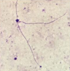 <p>Identify the sperm morphology.</p>