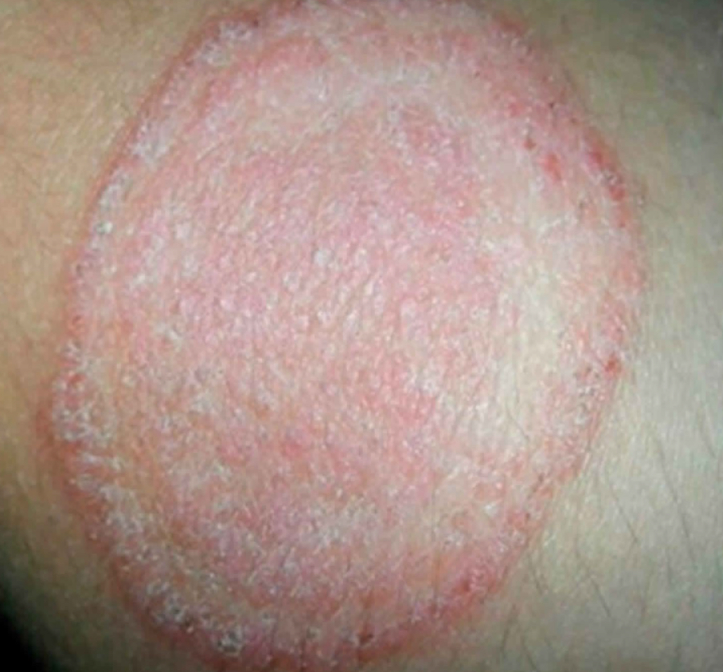 <p>what shape/arrangement and condition is depicted</p>