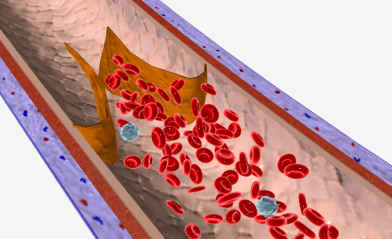 <p>What type of blood vessel is depicted here?</p>