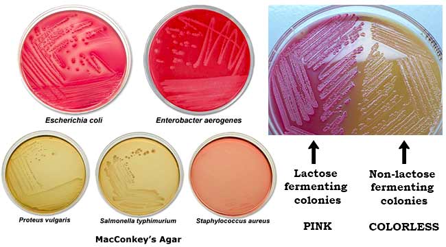 <ul><li><p>identifies lactose fermentation, gram ⊖ enteric pathogens (differential) and inhibits gram ⊕ (selective)</p></li><li><p>fermentation of lactose turns medium red/pink due to acidic environment </p></li></ul>