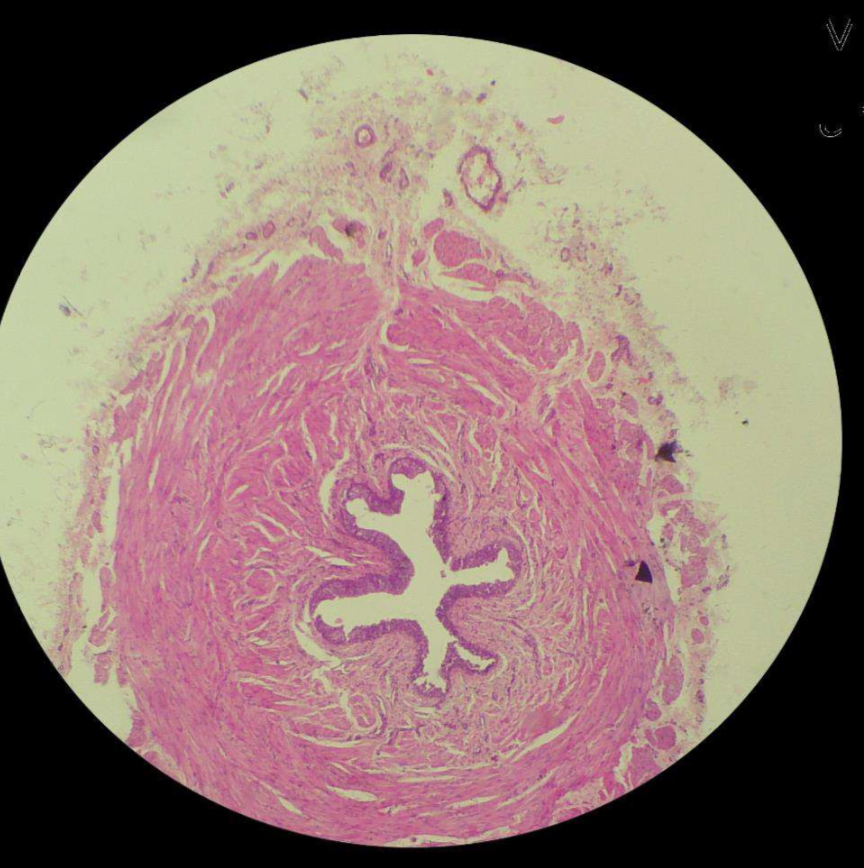 <p>Ureter</p>