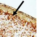 <p>What is this image pointing to?</p>