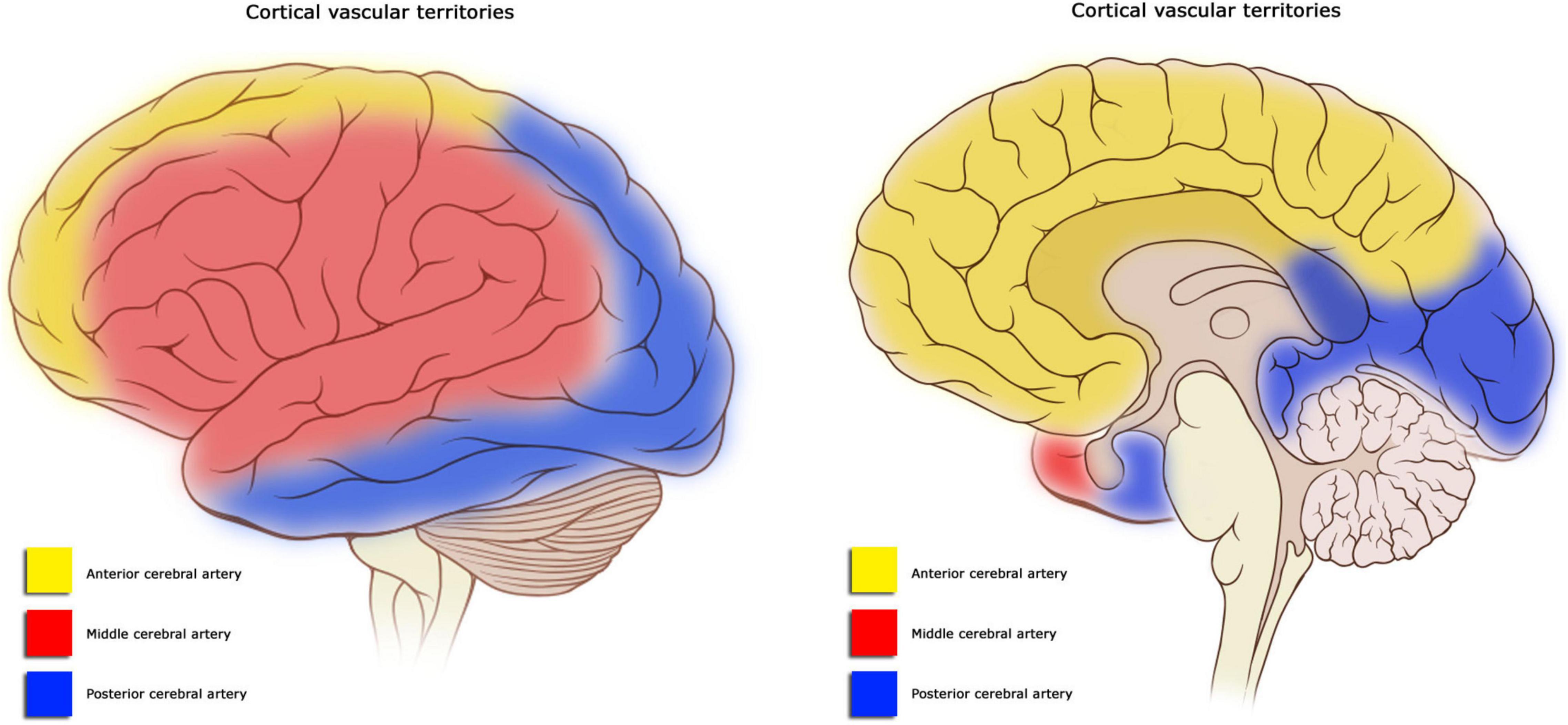 <ul><li><p>sensorimotor deficits in the contralateral face & UE</p></li><li><p>contralateral homonymous hemianopsia</p></li><li><p>L hemisphere → aphasia</p><ul><li><p>superior division of MCA → Broca’s</p></li><li><p>inferior division of MCA → Wenicke’s</p></li><li><p>main stem of MCA → global aphasia</p></li></ul></li><li><p>R hemisphere → perceptual deficits (unilateral neglect)</p></li></ul><p></p>
