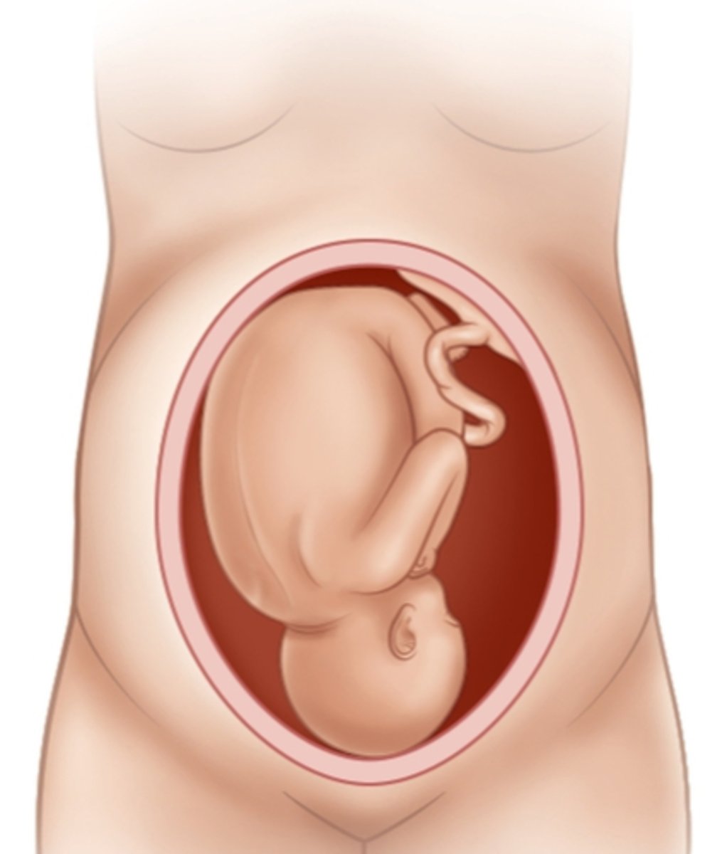 <p>-most common</p><p>-either the head or buttocks of the fetus enter the pelvis first</p><p>-lie is longitudinal and parallel to the mom</p>