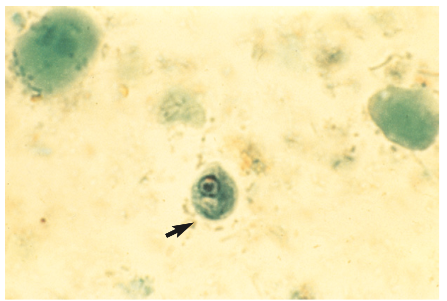 <p>A non-pathogenic intestinal protozoan.</p>