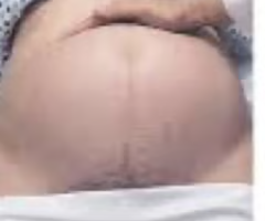 <p><span>determines shape, size, consistency, and mobility of presenting part</span></p>