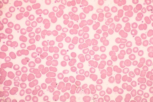 Description: red and white blood cells in a fluid matrix (plasma)
Function: transport respiratory gases, nutrients, wastes, and other substances
Location: contained within blood vessels