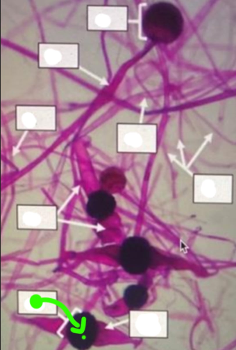 <p>Reproductive cells capable of developing into new fungi under suitable conditions.</p>
