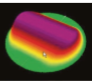 <p>Ametropi behandlet</p>