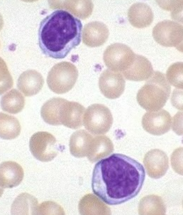 <p>same size as erythrocytes, thin band of clear cytoplasm around a spherical nucleus</p>