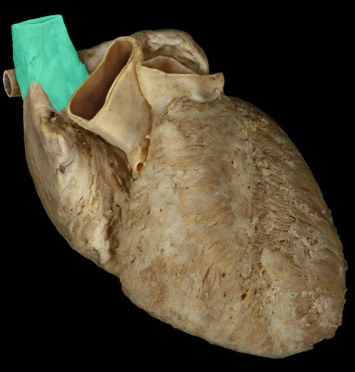 <p>Superior vena cava</p>