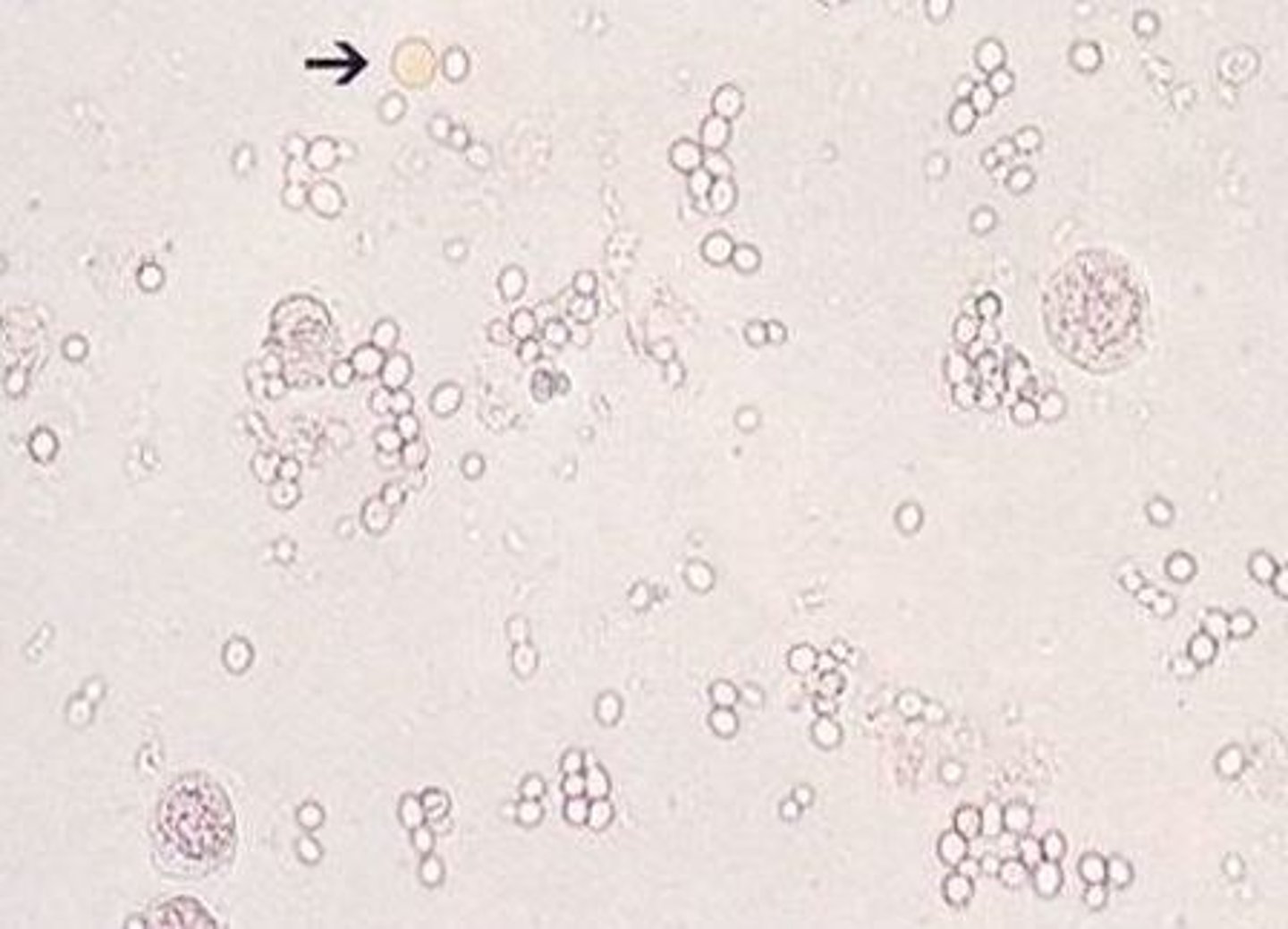 <p>B</p>