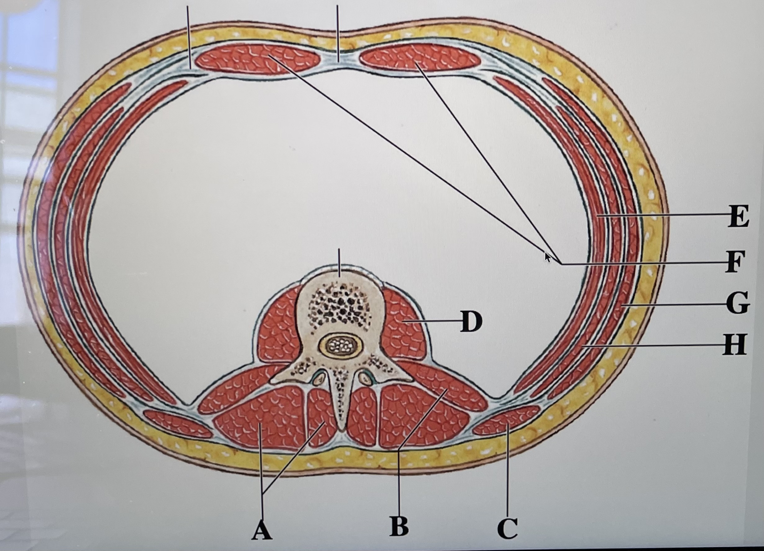 In the figure above,  *is the external oblique and* _is the Rectus abdominis 