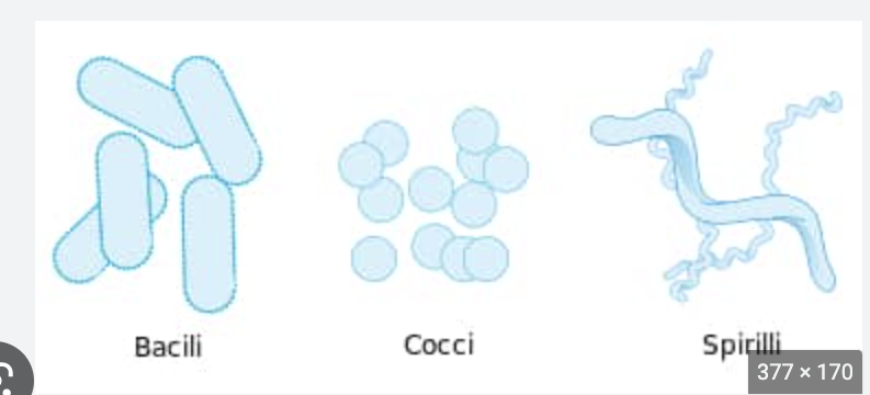 <p>Bacillus, Coccus, or sprial</p>