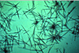 <p>Identify the urine sediment elements present in this illustration:</p>