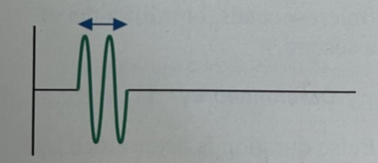 <p>pulses of short duration</p>