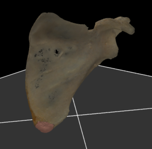 <p>de onderste hoek van de scapula</p>