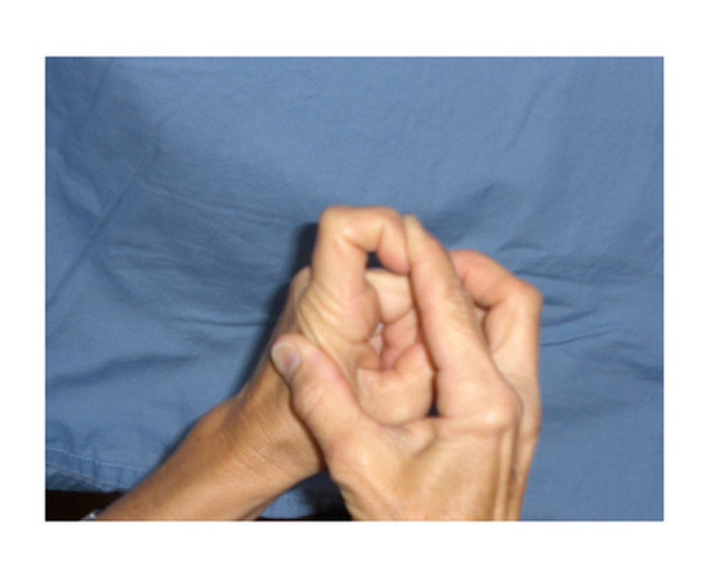 <p>PIP/DIP in flexion, MCP gently stretched into extension</p>