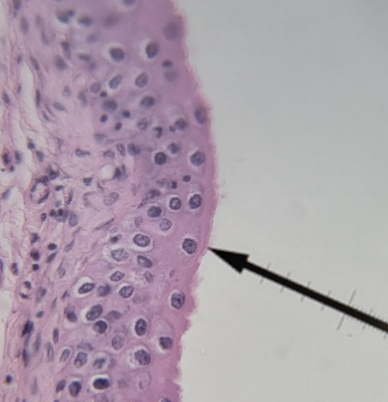 <p>what type of tissue is this </p>