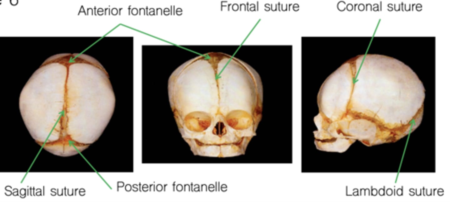 <p>"Soft spots" in infant skulls</p><p>Close at various times</p><p>- Posterior fontanelle (sagittal &amp; lambdoid suture): by 6 months</p><p>- Anterior fontanelle (frontal &amp; coronal sutures): ~middle of second year</p>