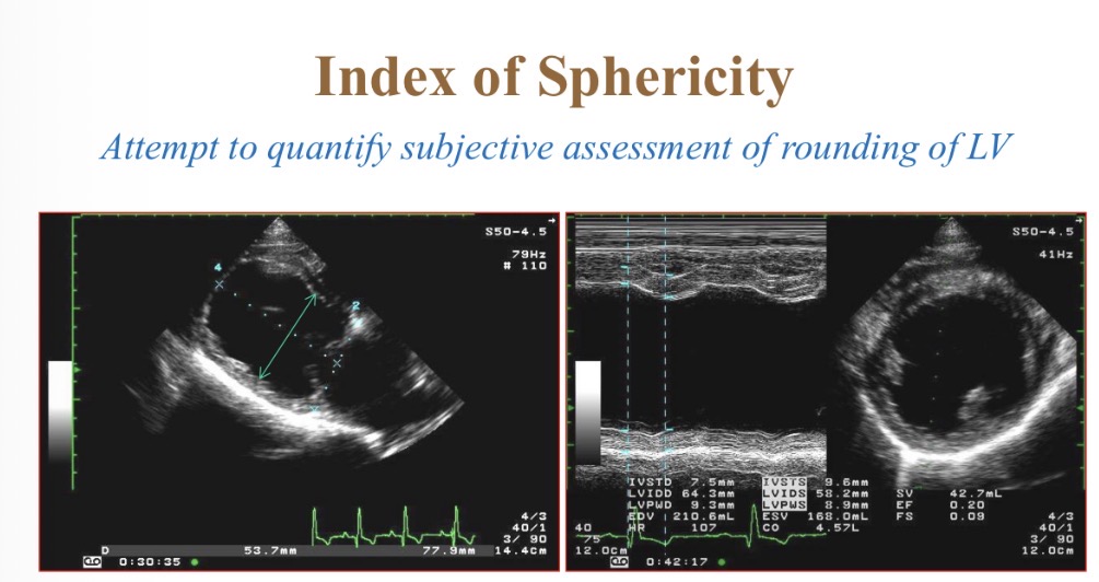 <p>Index of sphericity for LV equation </p>