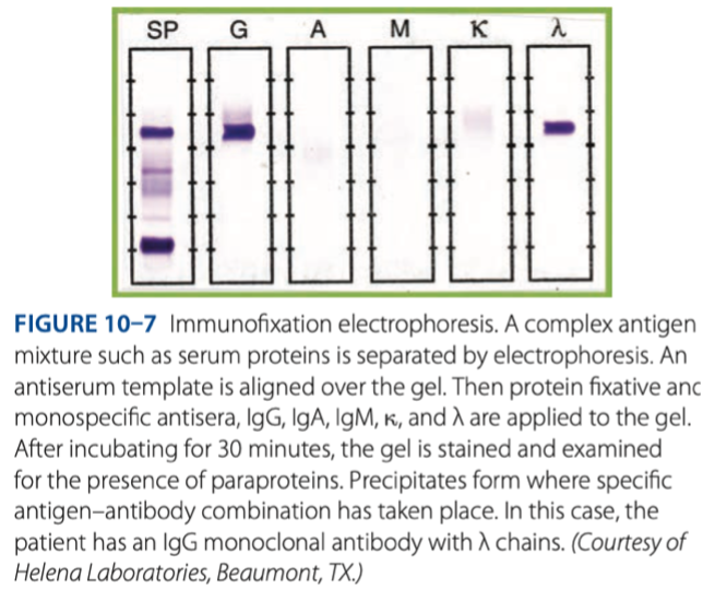 <p>Immunofixation Electrophoresis </p>