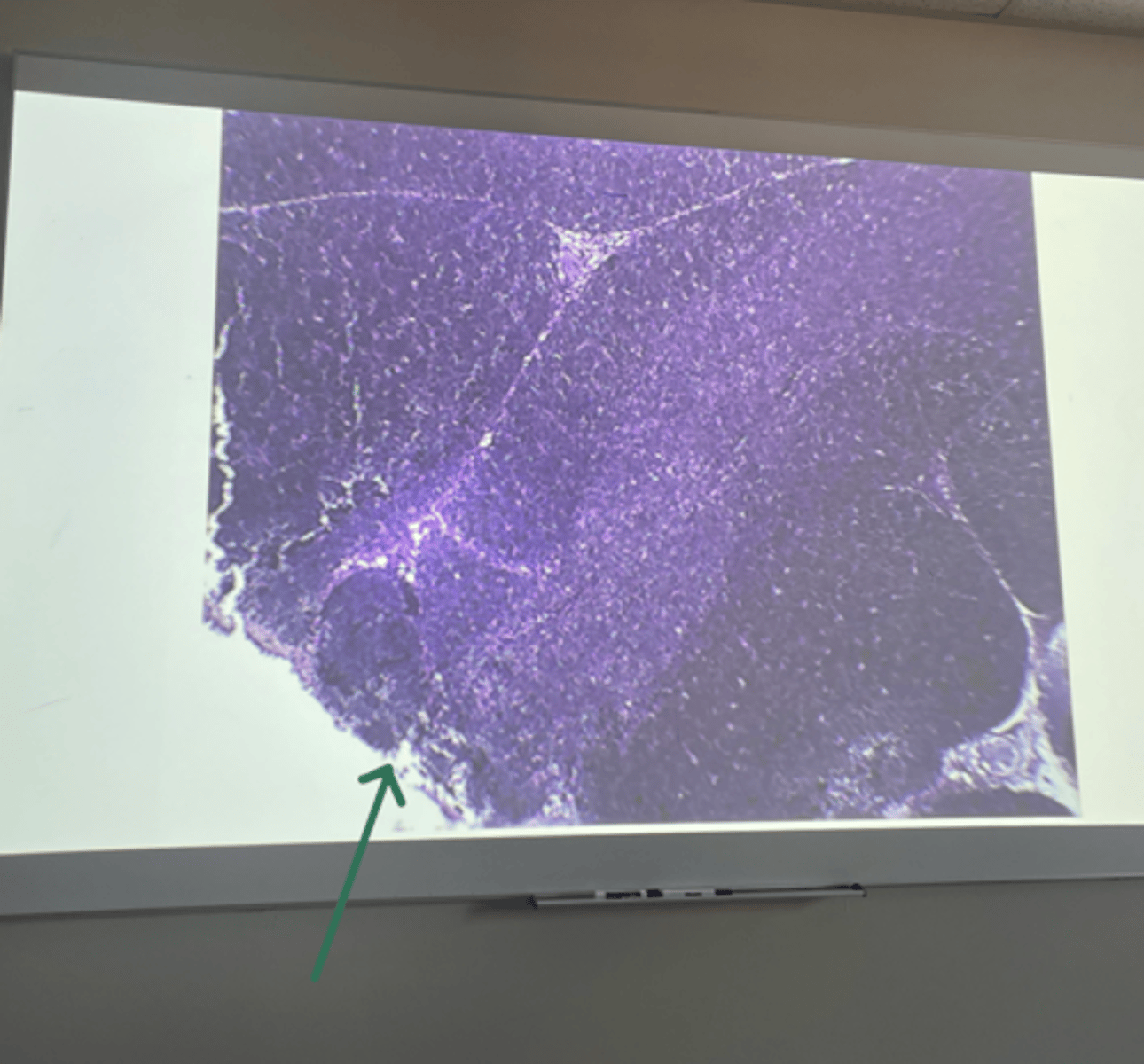 <p>gland and structure</p>