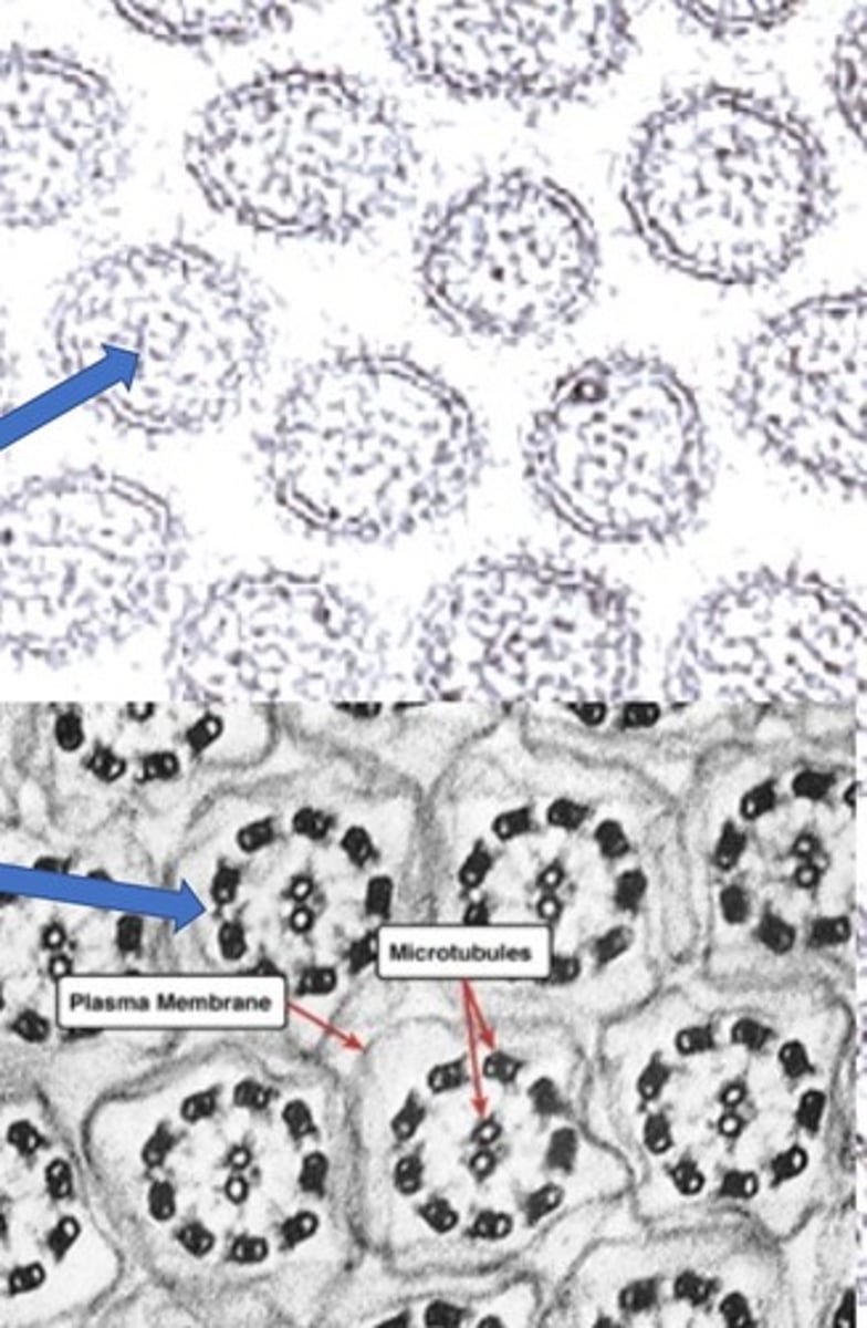 <p>- When using an electron microscope, microfilaments (villi) appear as dots which are randomly organized, microtubules (cilia) appear as circles that are organized.</p>