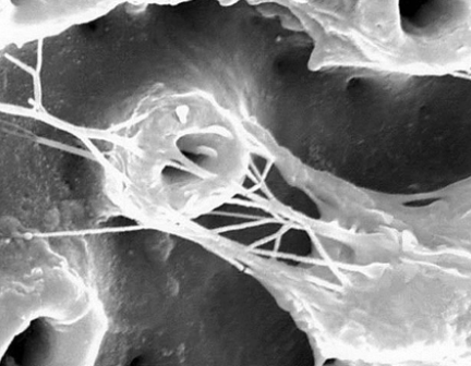 <p>Why is a moderately rough surface beneficial?</p>